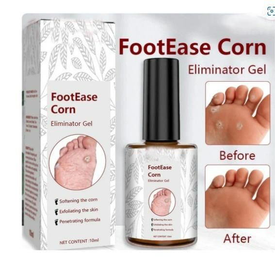Feet Corn Removal Serum ( Pack Of 2 )
