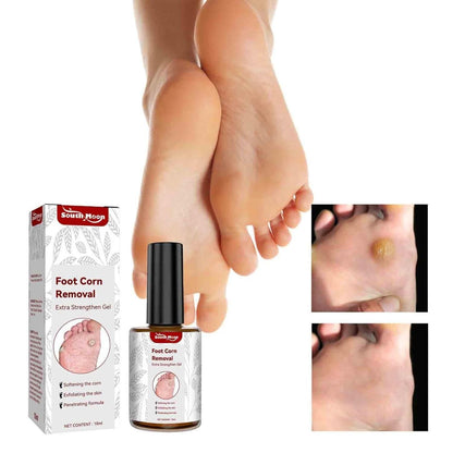 Feet Corn Removal Serum ( Pack Of 2 )