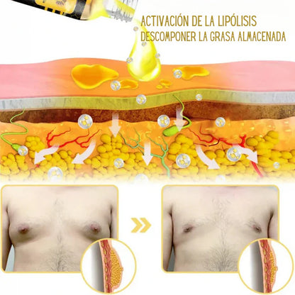 Bee Venom Gynecomastia Heating Oil 150 ml (Pack of 2)