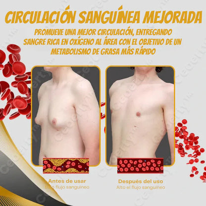 Bee Venom Gynecomastia Heating Oil 150 ml (Pack of 2)